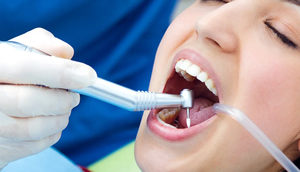 Dental Clinic Teeth Cleaning Price: A Guide for Sector 91 Residents
