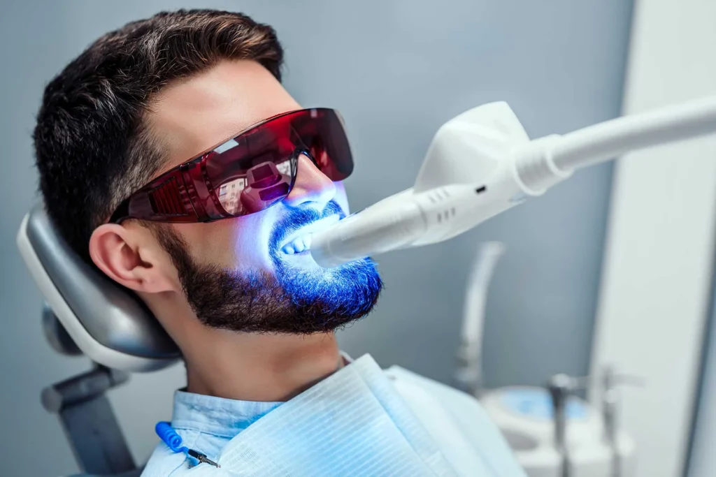 Teeth Whitening Benefits from a Dental Clinic in Sector 91, Gurgaon