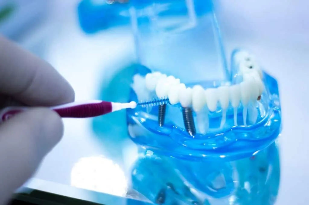 Expert Implant Care Dental Clinic in Sector 90, Gurgaon